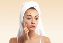 How Long to Leave Pimple Patch On: The Right Way to Use It for Best Results