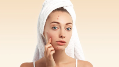 How Long to Leave Pimple Patch On: The Right Way to Use It for Best Results